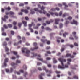 Histopathology OOD classification 